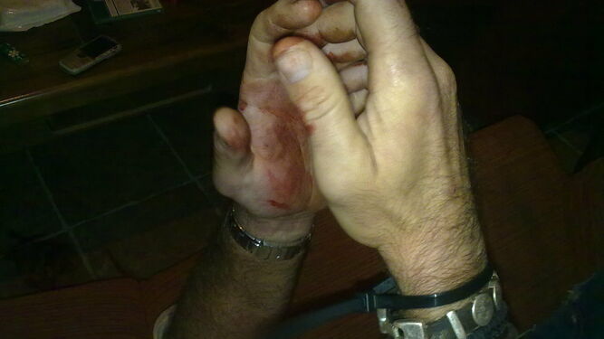 Estas manos corresponden a un hombre liberado por la Guardia Civil en Conil tras ser secuestrado.