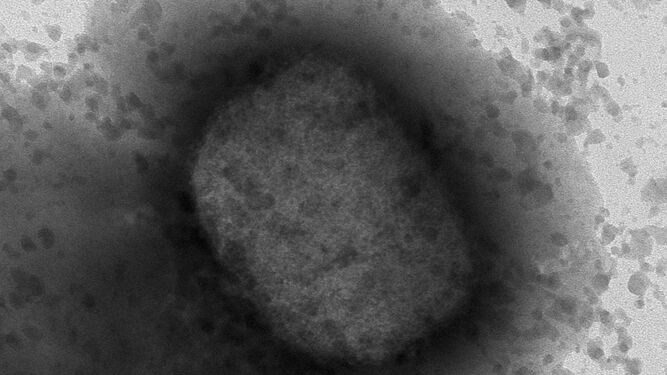 El virus de la viruela del mono visto con un microscopio