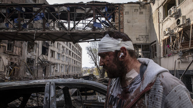 Un hombre herido por los bombardeos rusos camina por la ciudad ucraniana de Jarkov.
