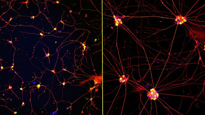 Imágenes fluorescentes de neuronas humanas (teñidas con rojo, verde y azul) creciendo sobre recubrimientos con moléculas de movimiento rápido (izquierda) o laminina convencional (derecha) durante 72 horas.